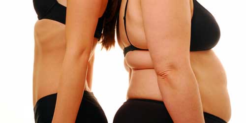 肥満の原因｜皮下脂肪と病気のリスク